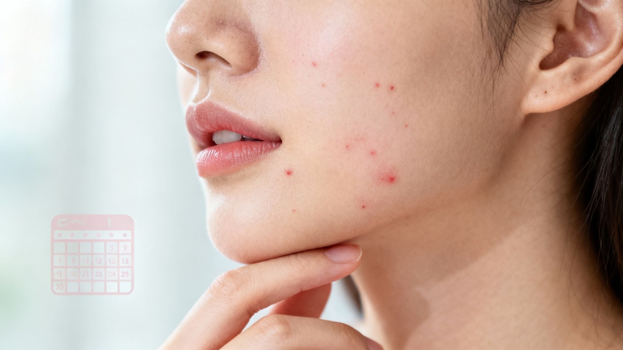 Pickel während der Periode – Ursachen verstehen und gezielt handeln